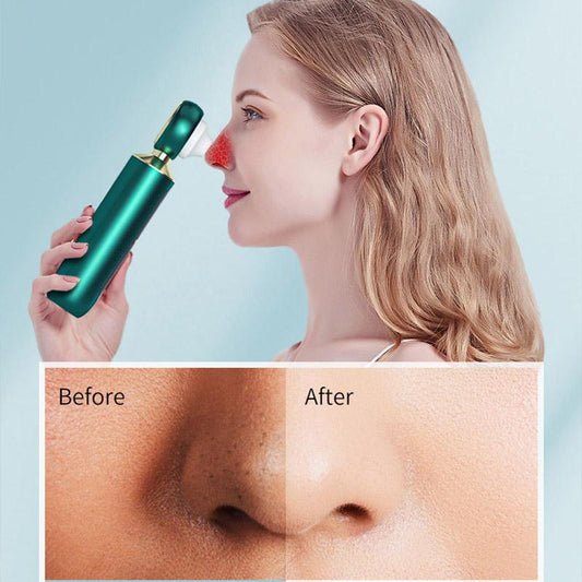 Visual Blackhead Suction Device Powerful Blackhead Suction Device Cleansing Devices Clean Pores Blackhead Acne Beauty Device